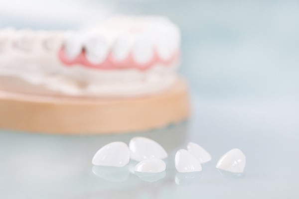 Fix A Chipped Tooth With A Dental Veneer